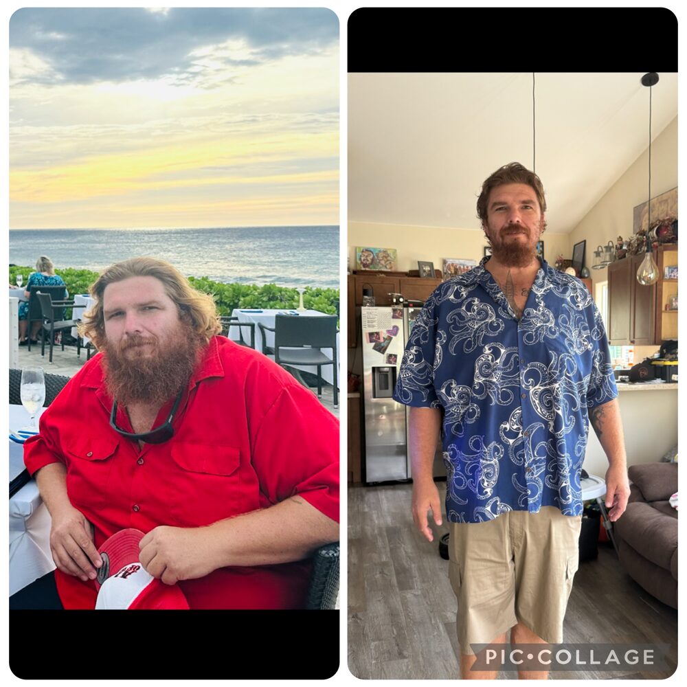 Commotion Fitness coaching client — outdoor before-photo and indoor after-photo showing major weight loss with Brad Oana coaching.